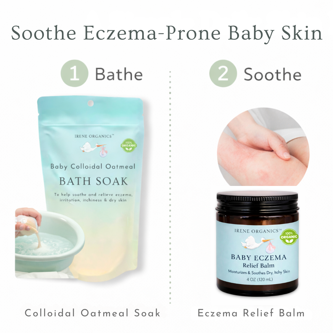 Eczema Baby Skincare Duo