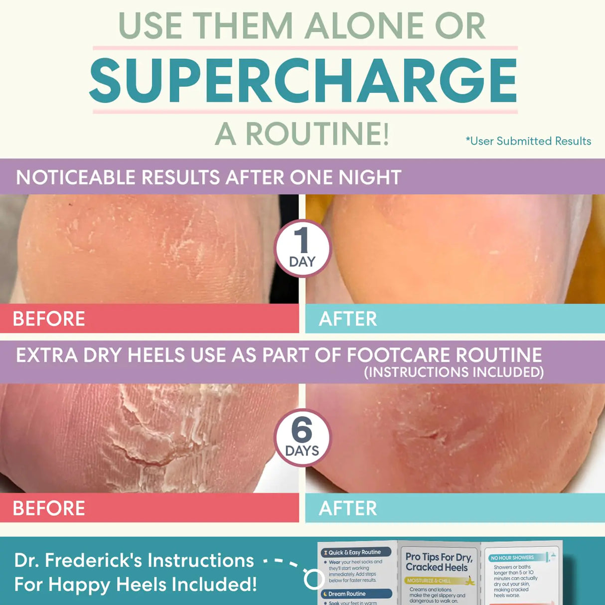 Dr. Frederick's Original Moisturizing Heel Socks for Cracked Heel Treatment - 2 Pairs - Heel Socks for Dry Cracked Feet - Cracked Heel Repair - Heal Dry Heels - Foot Care for Women & Men - Jojoba Oil