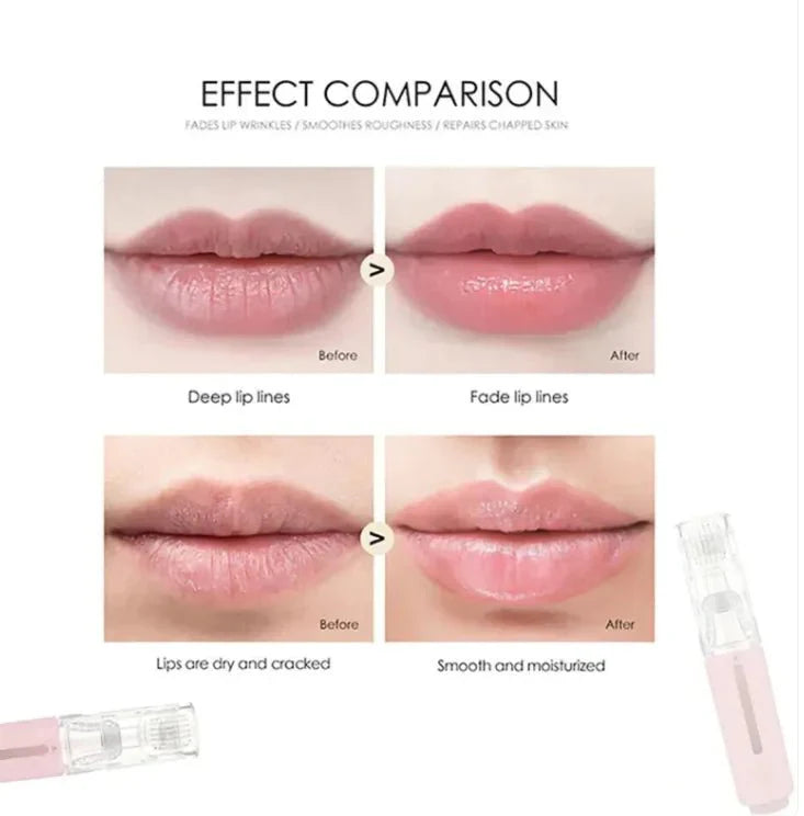 3-in-1 Lip & Beard Growth Roller