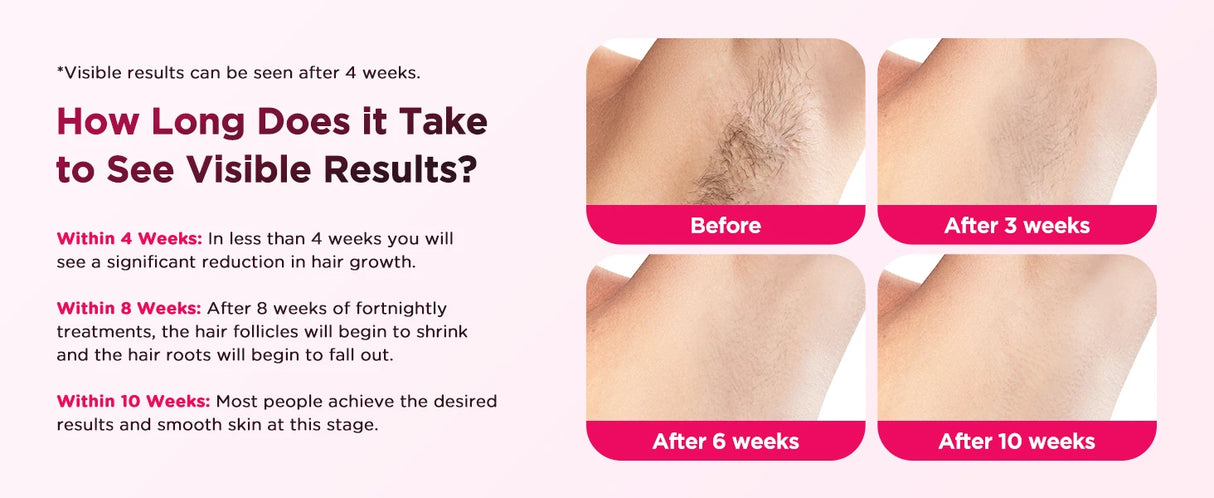 2026 IPL Pulsed Light Hair Removal Device with Cooling Function, 999,900 Flashes, 3-in-1 Laser Hair Removal Device [HR/SC/RA] for Women & Men, 9 Energy Levels for Underarms/Bikini Line/Body