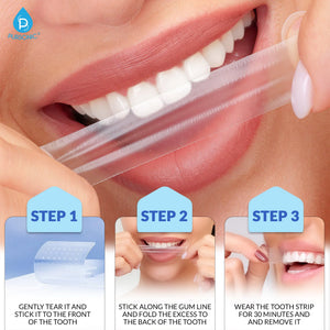 Total Smile Confidence System: Professional Teeth Whitening Strips, Teeth Whitening Serum & Teeth Whitening Pen