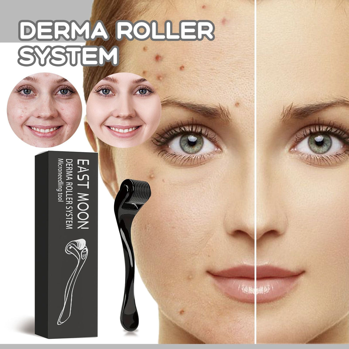 East Moon Facial Massage Roller To Reduce Fine Lines Closed Acne Rejuvenation Face Massage Treatment