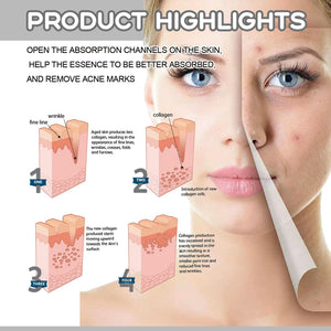 East Moon Facial Massage Roller To Reduce Fine Lines Closed Acne Rejuvenation Face Massage Treatment