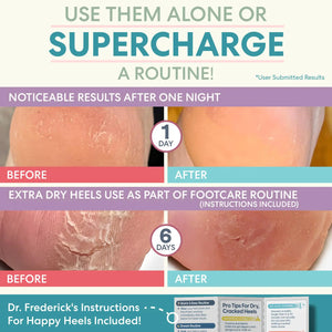 Dr. Frederick's Original Moisturizing Heel Socks for Cracked Heel Treatment - 2 Pairs - Heel Socks for Dry Cracked Feet - Cracked Heel Repair - Heal Dry Heels - Foot Care for Women & Men - Jojoba Oil