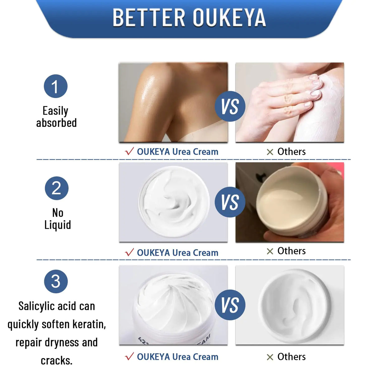 Urea Cream 42% plus Salicylic Acid 2% Net 5.29 Oz for Dry Cracked Feet, Heels, Knees, Elbows, Hands Repair Treatment. Moisturizes and Removes Corns, Calluses, Dead Skin, and Softens Toenails 5.29 Ounce(Pack of 2)